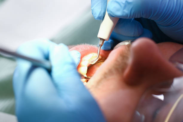 Best Emergency Broken Tooth Repair in Laurel Bay, SC